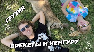 Грузия, брекеты и кенгуру