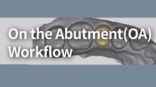 On the Abutment(OA) Workflow(ENG)