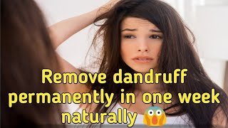 Remove Dandruff Permanently In One Week Naturally 😱