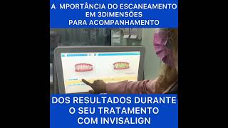 Você sabe como acompanhamos o tratamento de Invisalign by Prada Odontologia ?