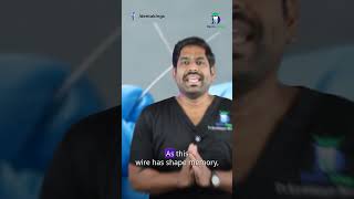 இரண்டு வகை கம்பிகளா? - NiTi vs SS Wires in Braces | Dr.Karthikeyan | Denta Kings