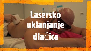 Bosanac na laserskoj DEPILACIJI !! Ursa