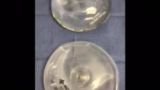 Different types of breast implants