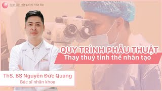 Mổ đục thuỷ tinh thể (cườm khô) được diễn ra như thế nào? | Bệnh viện mắt quốc tế Nhật Bản