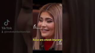 #kyliejenner #ruined her face #cheek #implants #subscribe  #kardashians #dailyuploads #tiktok