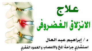 علاج الانزلاق الغضروفى مع الدكتور ابراهيم عبد العال استشارى جراحة المخ والاعصاب والعمود الفقرى.