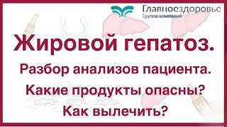 Жировой гепатоз. Разбор анализов пациента. Какие продукты опасны? Как вылечить?