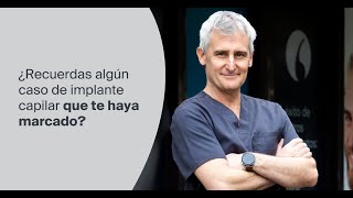 ¿Recuerdas algún caso de implante capilar que te haya marcado?