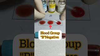 Blood Group "B"Negative #bloodgroup #bloodbanking #health #viralvideo