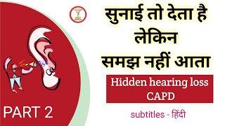 CAPD | Part 2 | Ear disease | Hearing loss | SNHL | Tinnitus |