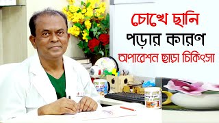 চোখে ছানি পড়ার কারণ ও চিকিৎসা | অধ্যাপক ডা.আব্দুল মান্নান | Cataract problems Bangla Tips