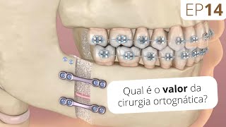 EP14 Qual o valor da cirurgia ortognática? I Instituto Maxiloface