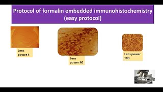 Protocol of formalin embedded immunohistochemistry (easy protocol)