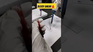 How to prepare perfect tongue shape blood smear 🩸#viralvideo #youtubeshorts #medical #youtube#shorts