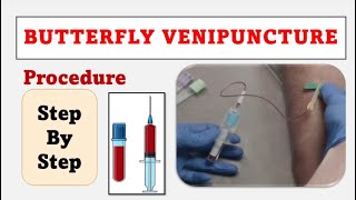 Butterfly Venipuncture Procedure with Easy steps|Blood Collection Method