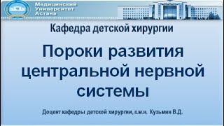 Врожденные пороки развития центральной нервной системы у детей