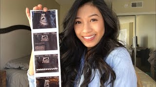 5-9 WEEKS Pregnancy Update | Ultrasound & Baby Bump