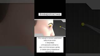 Блефаропластика - это хирургическое удаление избытков кожи и жировых отложений в области век.