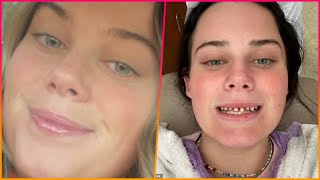 Young woman who went to the dentist for a simple root canal is horrified to discover that she had