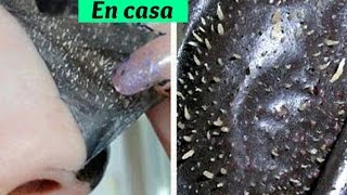 Como quitar puntos negros y espinillas de forma casera y facil