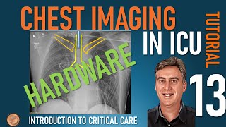 Chest Imaging in ICU - Part 2  - Hardware