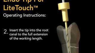 Animation Endo Tip Protocol - LiteTouch™ Er:YAG Dental Laser