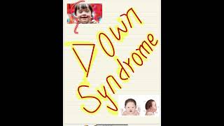 Down syndrome  🩺🩺💉💉💔💔