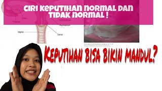 Jenis Keputihan Yang Berbahaya, Jangan Sepelekan!