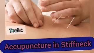 Acupressure Points for Stiff Neck