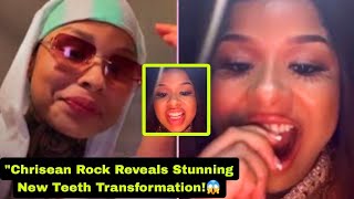 "Chrisean Rock Reveals Stunning New Teeth Transformation! 😱✨"