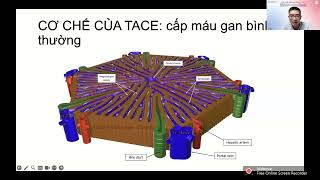 ĐIỀU TRỊ NÚT MẠCH HÓA CHẤT HCC: TẠI SAO LẠI THẤT BẠI? TS. NGUYỄN NGỌC CƯƠNG