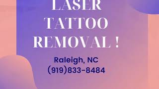 Laser tattoo removal first treatment large angel on full back on male