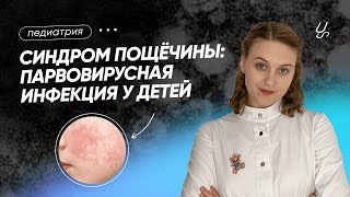 Синдром пощёчины: парвовирусная инфекция у детей