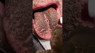 What happened to his TONGUE? 😳👅 #viral #funny #shorts