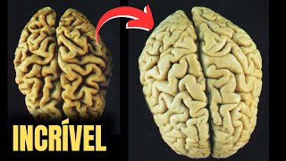 Não acredita em milagre? O Óleo que Cura o Mal de Alzheimer e Outras doenças | Dr Lair Ribeiro