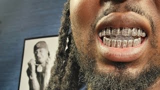 Shop Gld Instructions On Grillz And Full Review