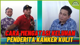 Cara Mengatasi Keluhan Pada Penderita Kanker Kulit