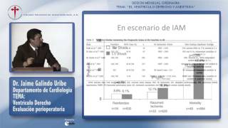 Ventrículo Derecho Evaluación Perioperatoria - Dr Jaime Galindo Uribe