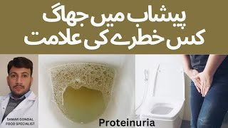 Foamy urine | frothy urine| bubbly urine | پیشاب میں جھاگ | protein in urine | proteinuria