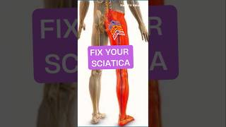 Fix your sciatica ☑️ #shorts #short #sciatica #sports