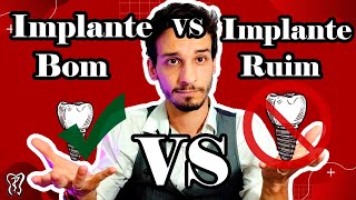 Implante Dentário Ruim vs Bom