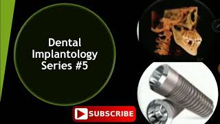 Dental Implants Review Series #5 - INBDE