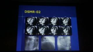 Cardiac Stress MR (Dobutamine & Adenosine) - Ashraf Hamdan