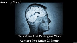 Top 5 Parasites And Pathogens That Control The Minds Of Their Human Hosts