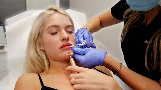 MORE PLASTIC SURGERY?! *vlog*