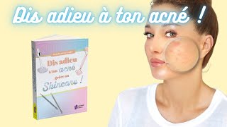 DIS ADIEU À TON ACNÉ GRÂCE AU SKINCARE