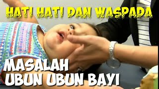 Ubun ubun bayi dan masalah ubun ubun bayi hati hati dan waspada