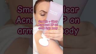 Clear KP Acne Bumps on Arms Legs + Body