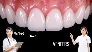 ทำให้ฟันขาวใน 1 นาที Get white teeth in 1 min