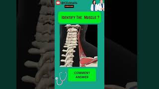 Identify the Muscle of upper limb quiz #anatomy #humananatomy #upperlimuscles